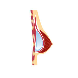Subglandular
