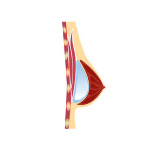 Subpectoral